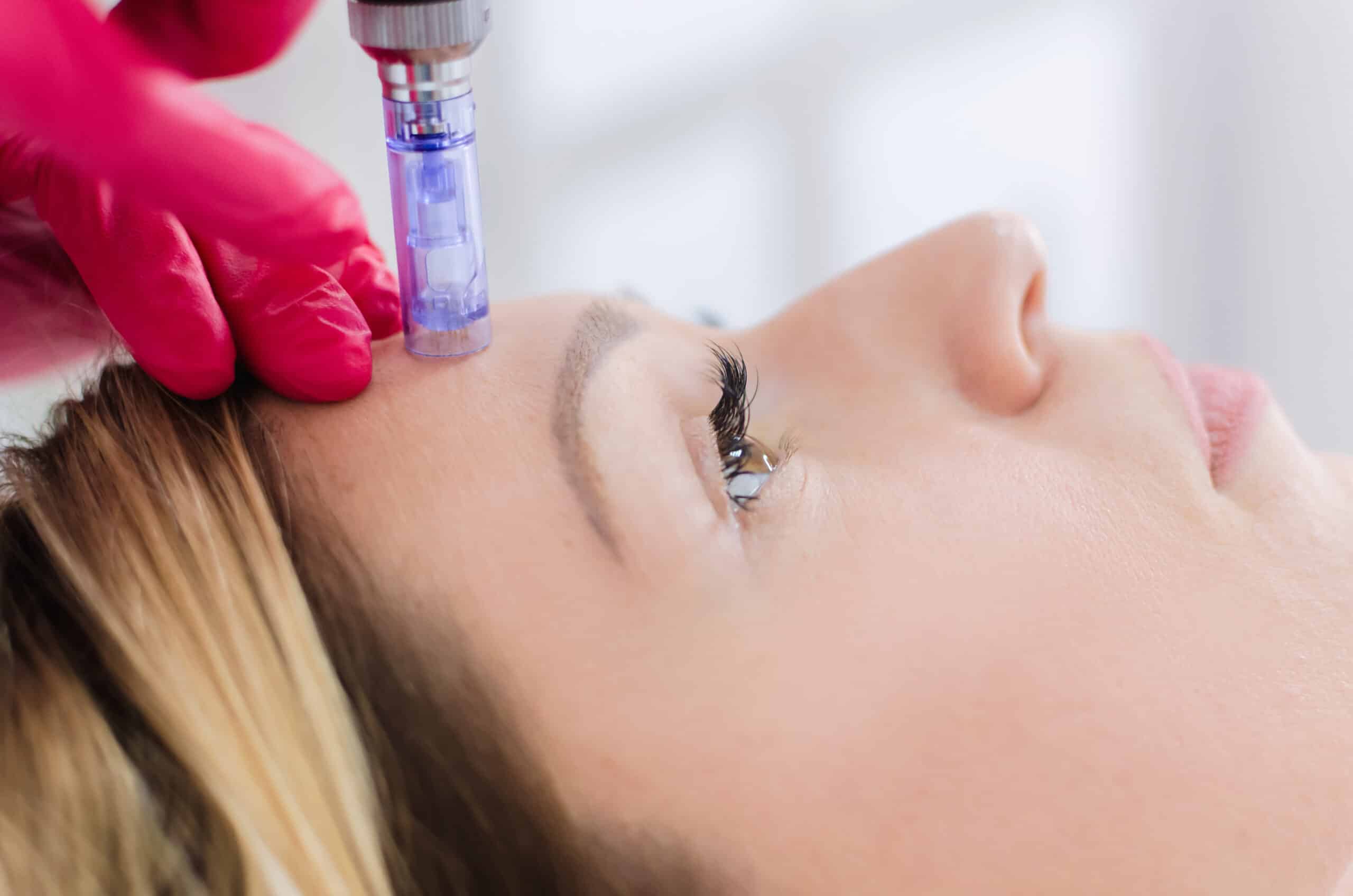 The Ultimate Guide to Hydrafacial Treatment: Rejuvenate Your Skin