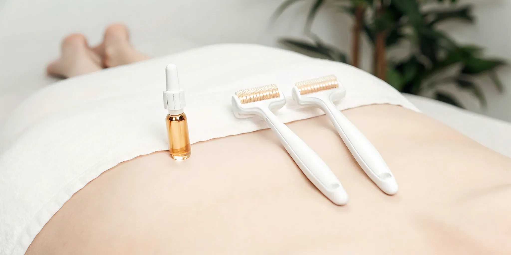 SkinPen microneedling with PRP treatment.