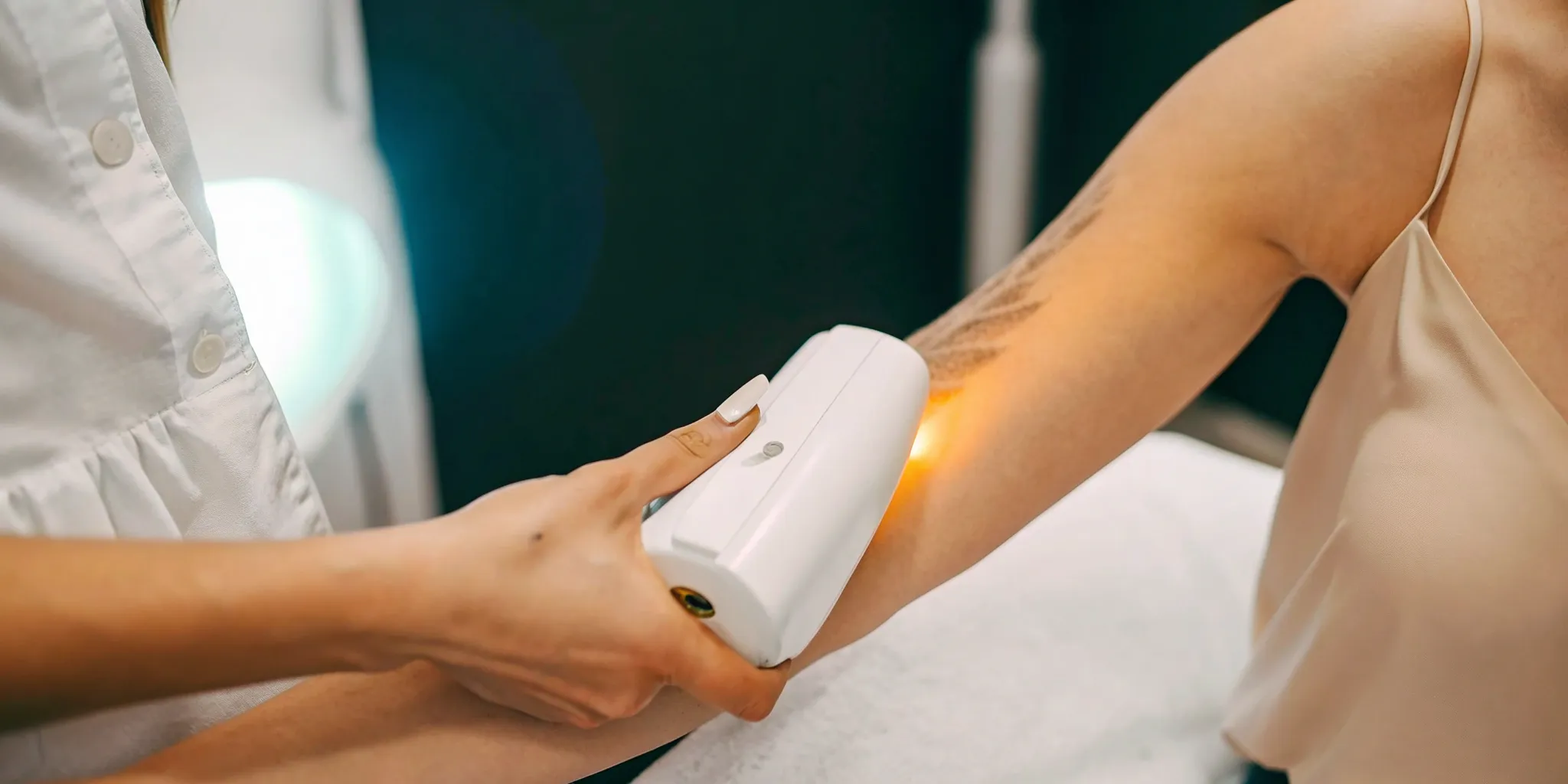 Laser tattoo removal treatment on an arm at a clinic in Frisco.