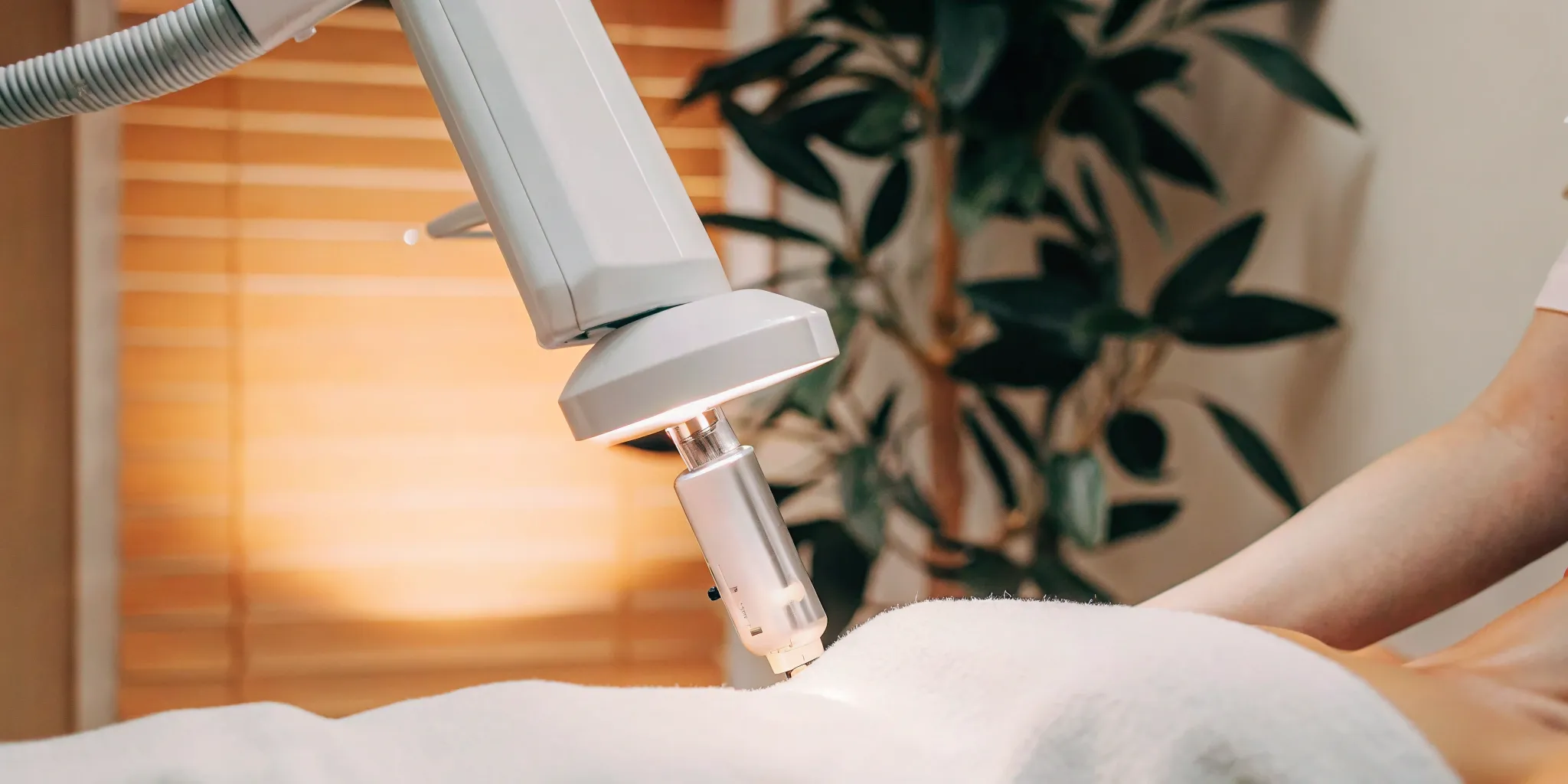 Laser tattoo removal on a patient's arm.