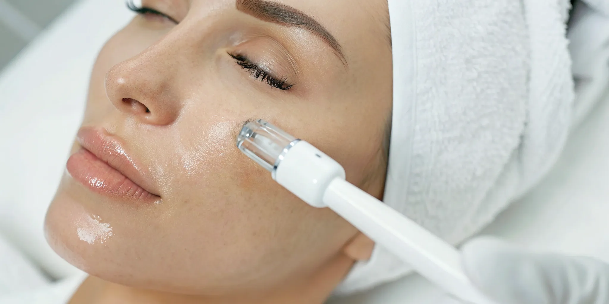 Microneedling treatment for fine lines being performed on a woman's face.