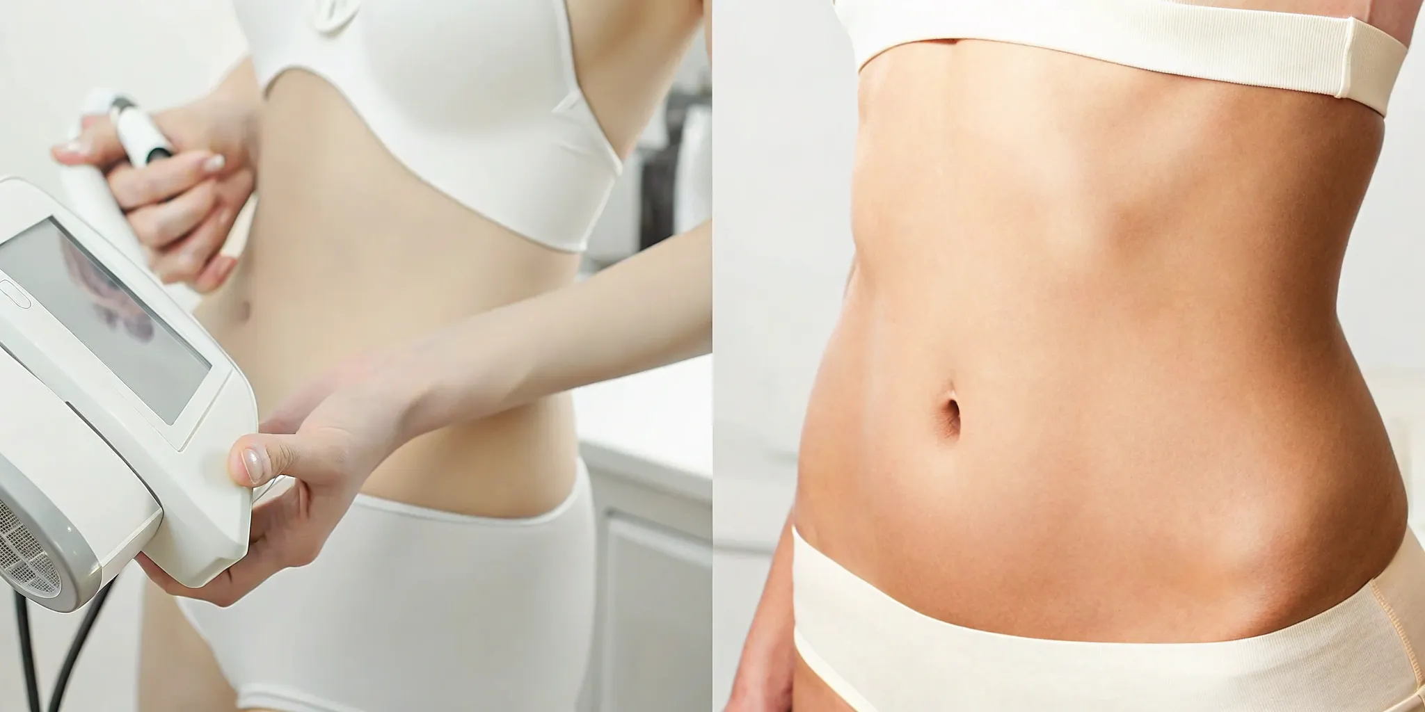 A woman's abdomen showing the body contouring results of Emsculpt Neo vs CoolSculpting.