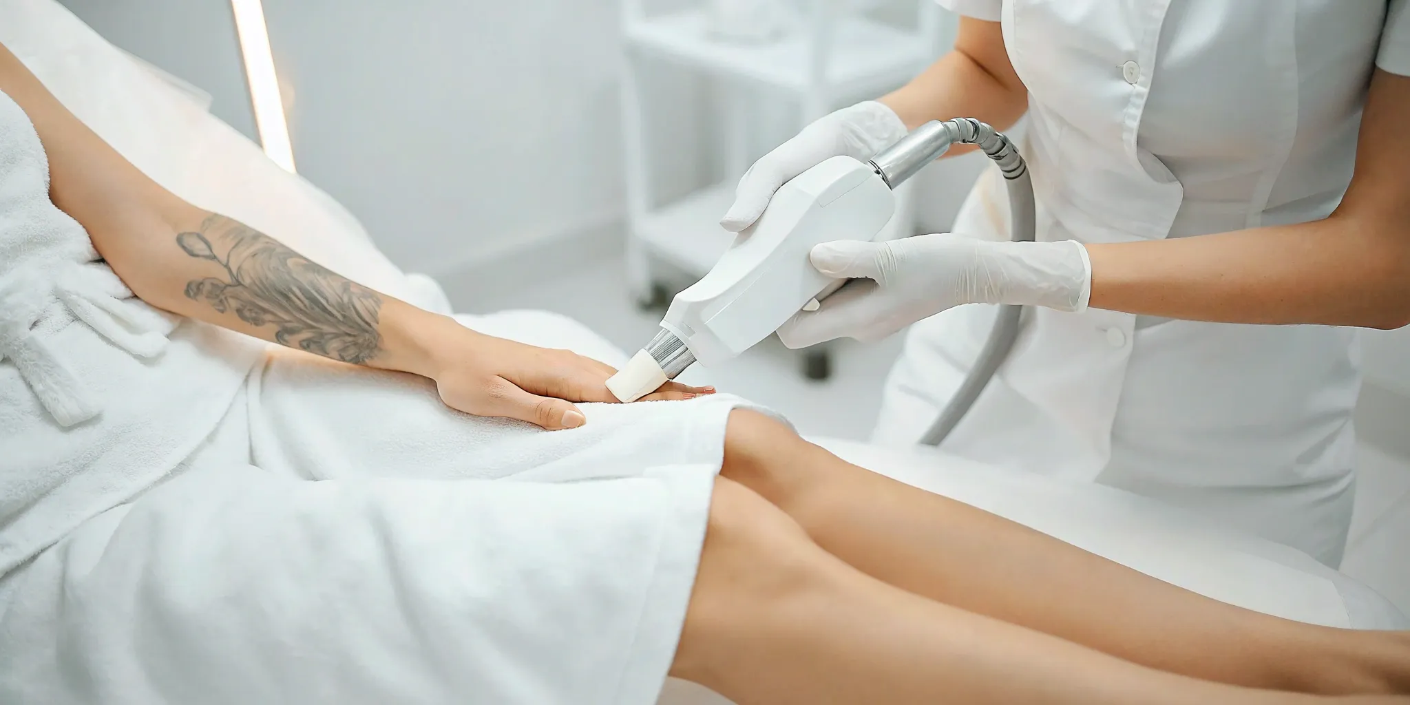 Laser tattoo removal on a hand.