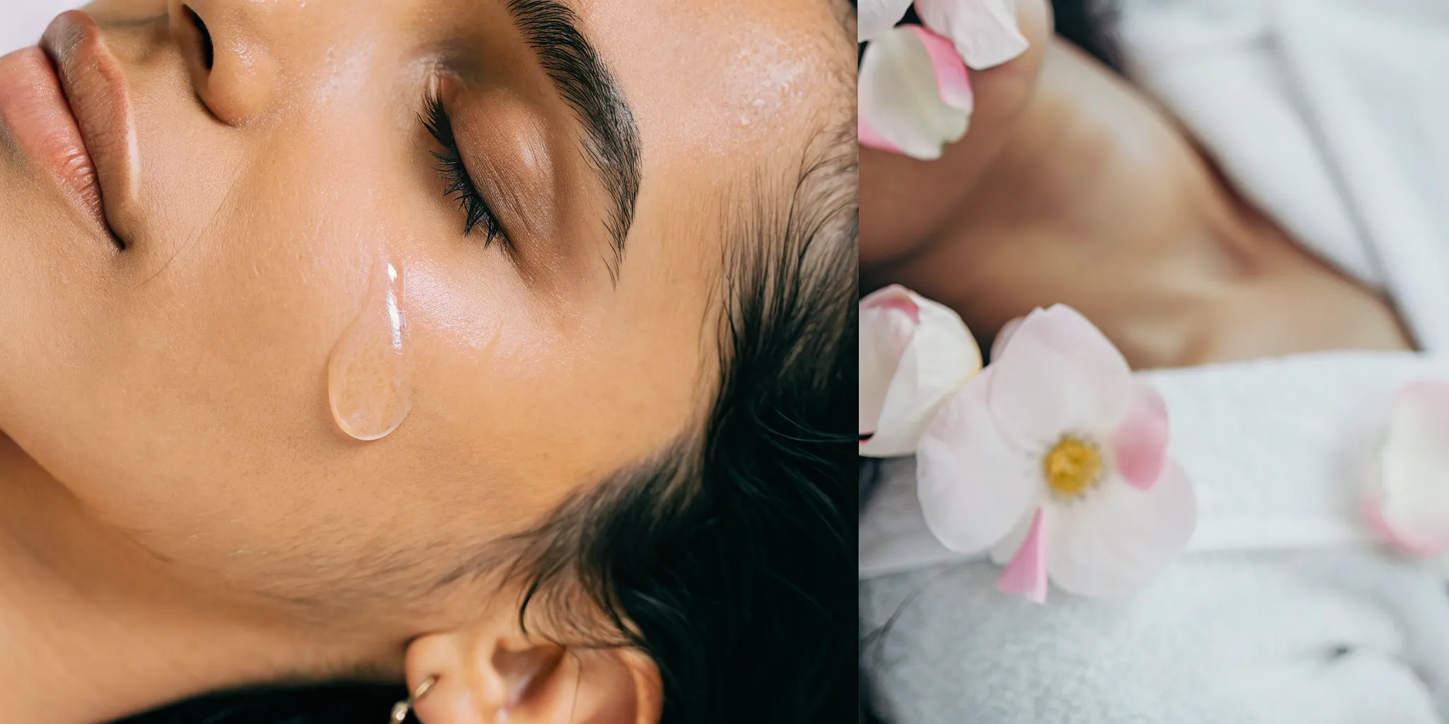 Glowing skin after a VI Peel.