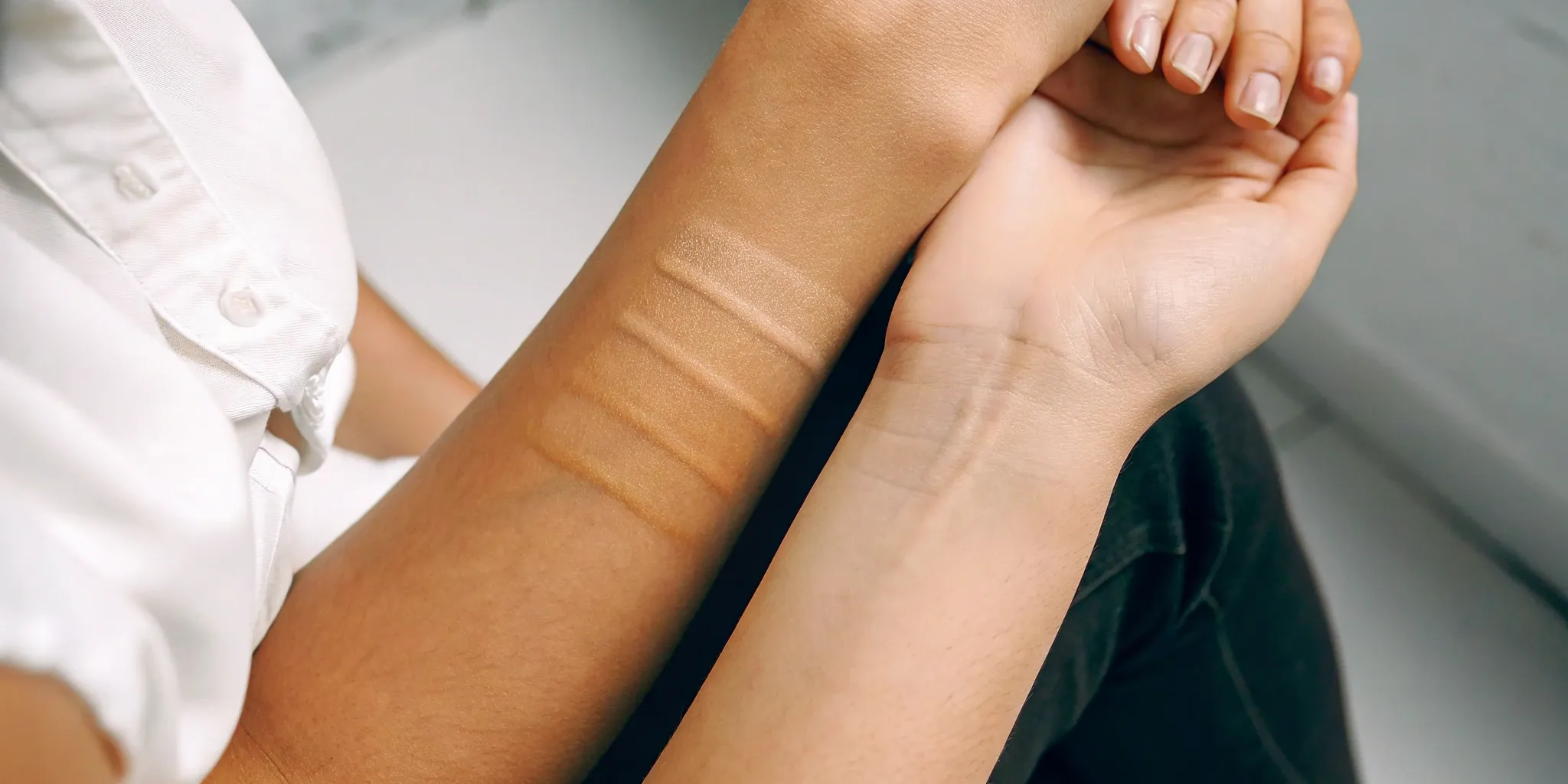 Affordable tattoo removal options for diverse skin tones.