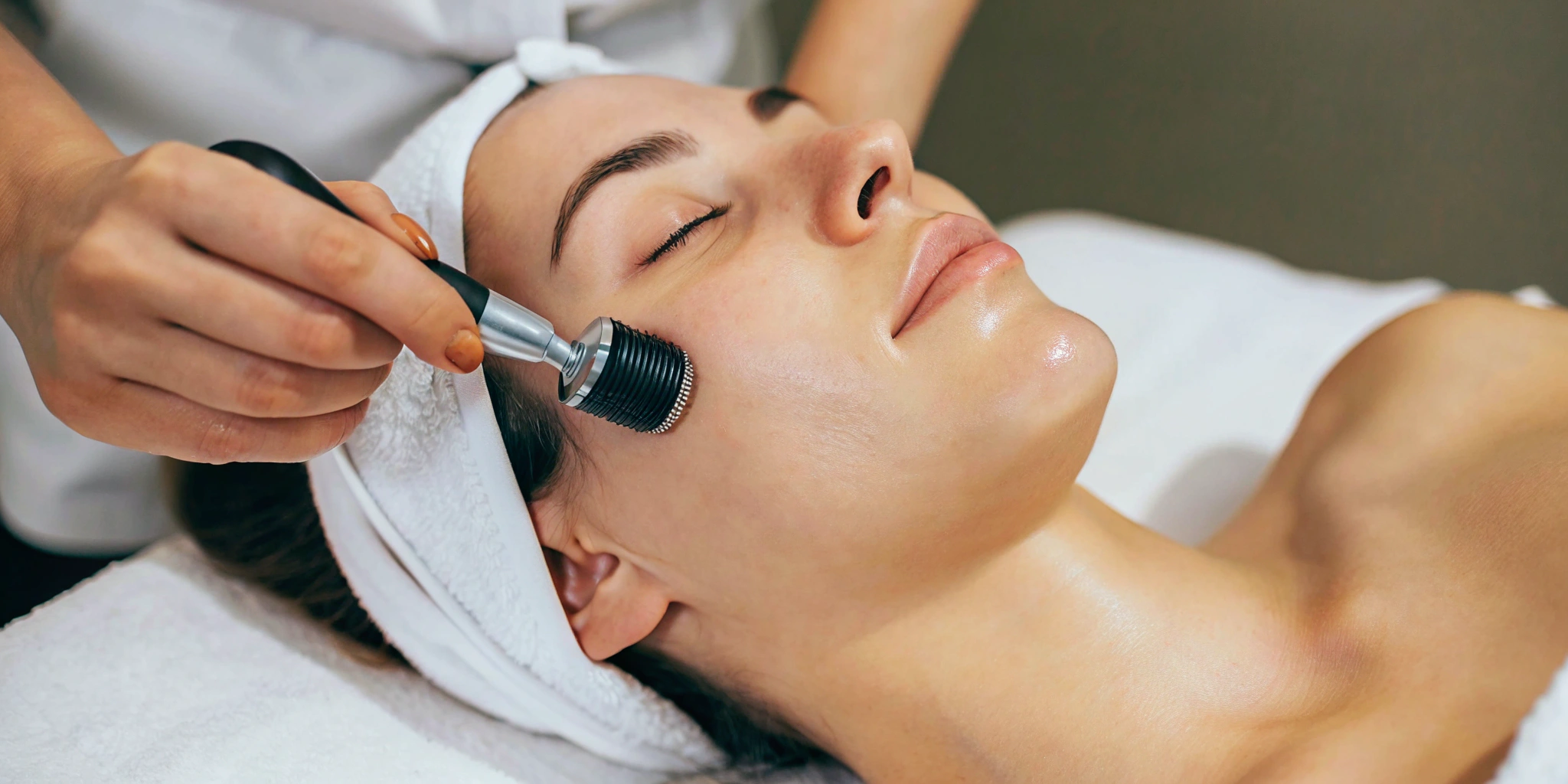 SkinPen microneedling device treating a woman's facial acne scars.
