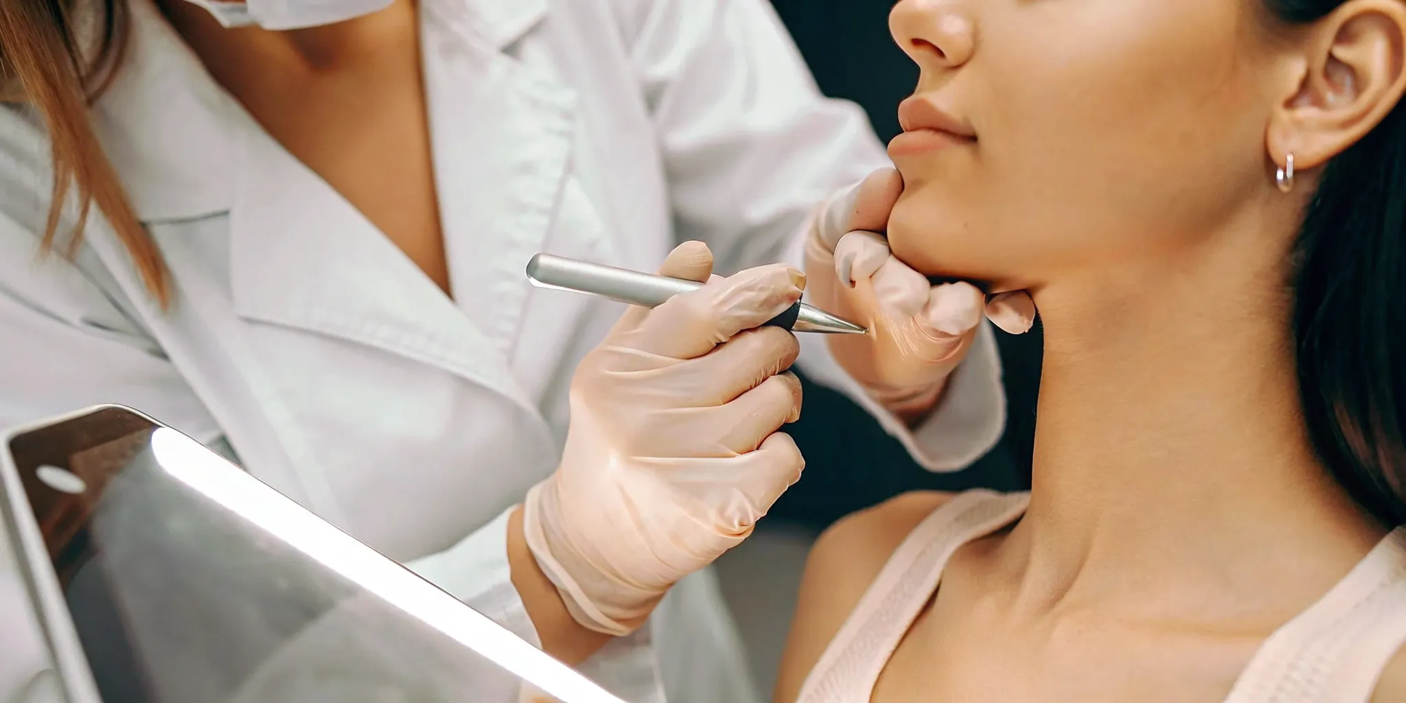 Dermatologist performing a microneedling session on a woman's face for acne scars.