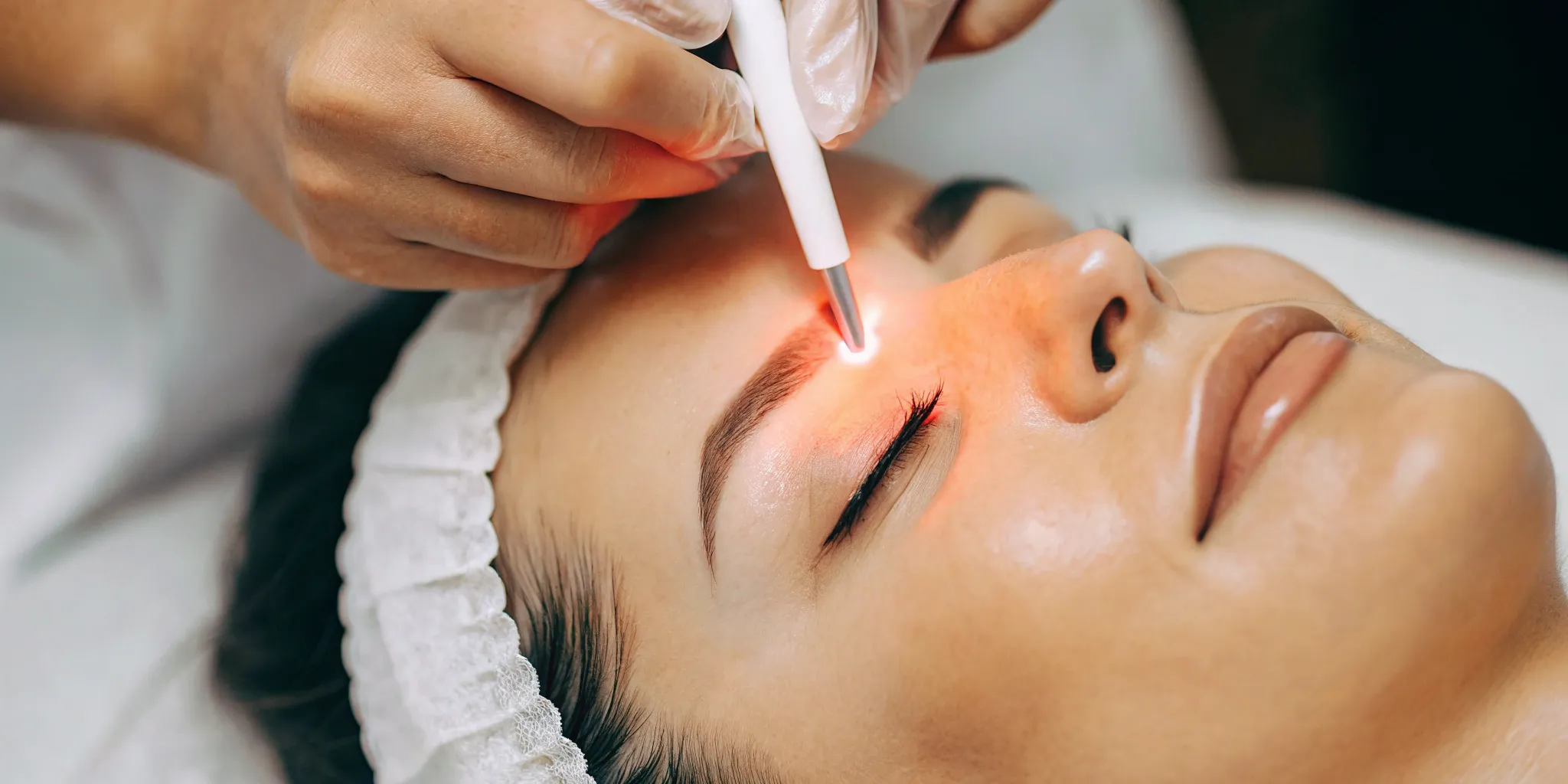 Precise eyebrow laser hair removal.